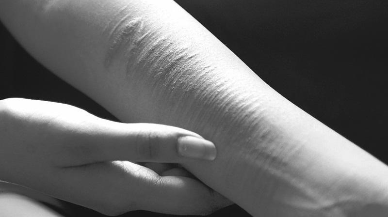 Шрамы на душе, шрамы на теле